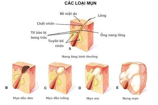 Sự khác biệt giữa kem cuộn thái lan và kem truyền thống